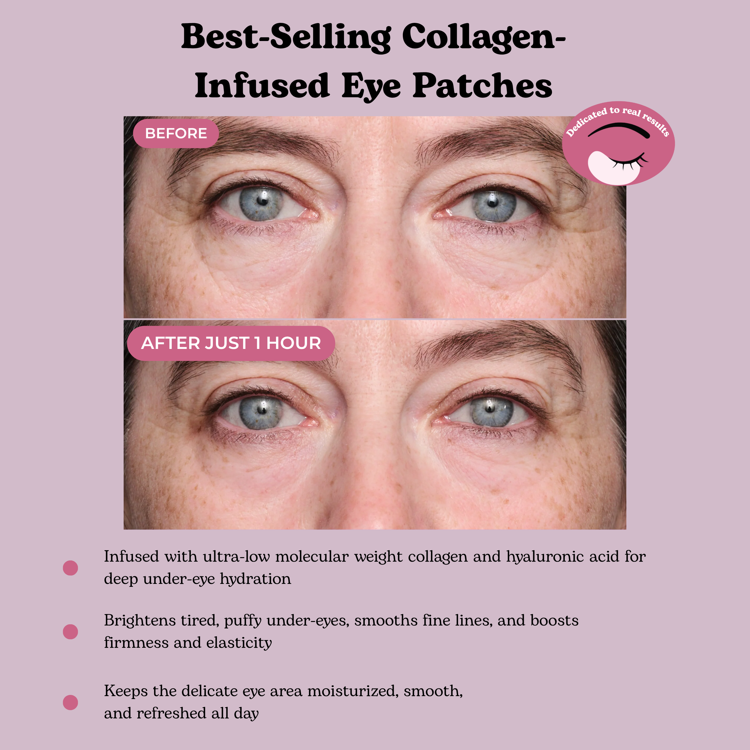 Collagen Infusion Tightening Eye Patches